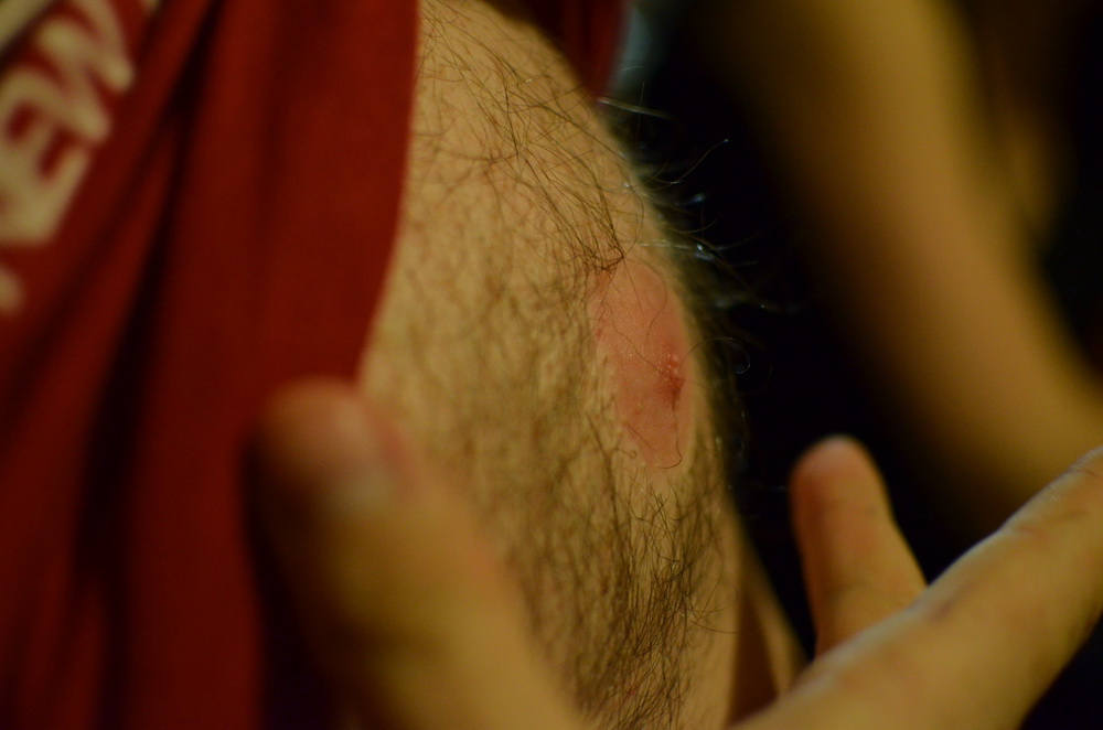 kdo prohraje, ukazuje kozy