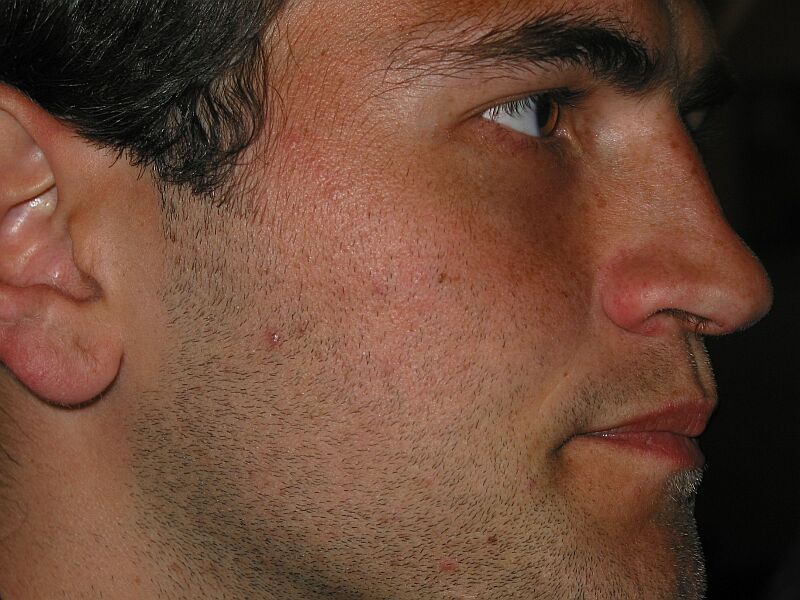 Tvářička jako prdelka