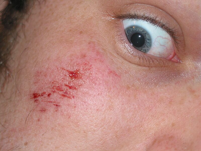 Rupek rozbil Peškovi držku