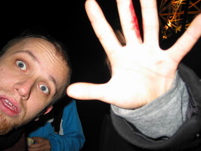 Vlčkův bojem zkrvavenej prostředník